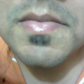 Amit
